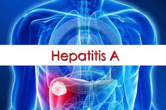 Penyelidikan Epidemiologi Hepatitis A